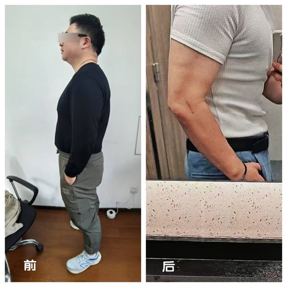 愿意配合饮, 下了医院减